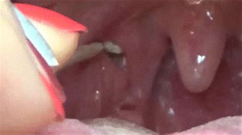 Cleaning Tonsil Stones Angiejoy Clips4sale