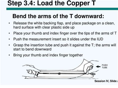 Copper T Insertion