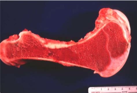 Path 2 Hematopoiesis Pictures Flashcards Quizlet