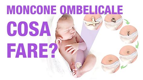 Come Prendersi Cura Del Moncone Ombelicale Del Neonato I Consigli