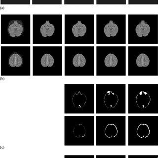 Representative Images Of Brain Extraction By The Proposed Method Bet