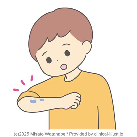 あざが出来た子ども | クリニカルイラスト