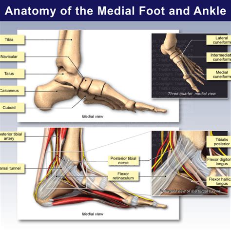Medical Legal Exhibits - Legal Animations & Trial Graphics - Tria... 