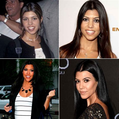 Kourtney Kardashian Before And After Nose