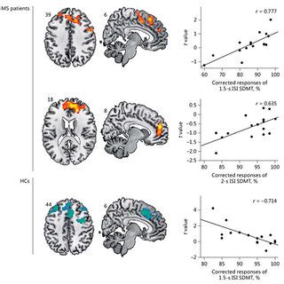 Correlations Between Cerebral Responses And Behavioral Execution For