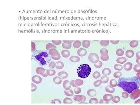 Enfermedades De La F Rmula Leucocitaria Ppt