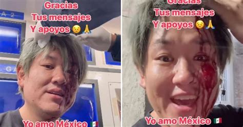 Joven Japonés Sufre Asalto En Monterrey Y Se Viraliza Al Expresar Que