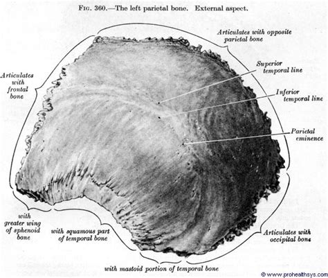 Parietal Bones - Prohealthsys