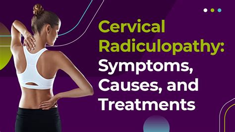 Cervical Radiculopathy Symptoms Causes And Treatments Youtube