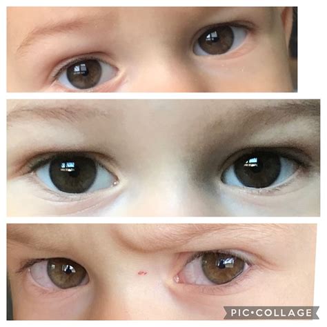 Hazel eyes color transition | BabyCenter