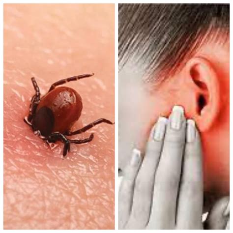 cara mengatasi telinga tersumbat karena flu 15