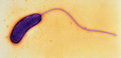 Microbiology Lab 4 Endospore Stain Flagella And Motility Capsule