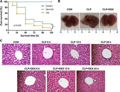 Frontiers Dexmedetomidine Protects Against Septic Liver Injury By