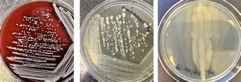 4 Colony And Cell Morphology Simple Stains Biology Libretexts