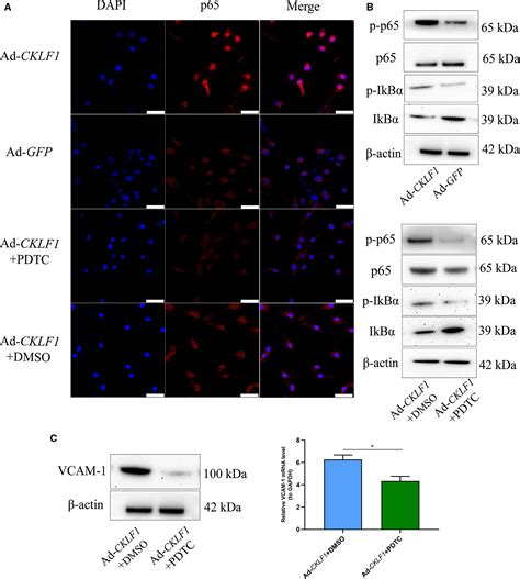 Chemokinelike Factor 1 CKLF1 Aggravates Neointimal Hyperplasia