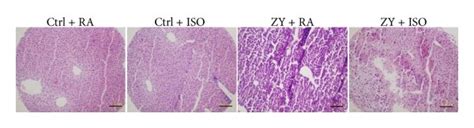 Iso Reduces Zy Induced Inflammation In Vivo And Improves Liver