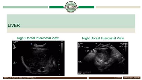 Basic Abdominal Ultrasound | PPT