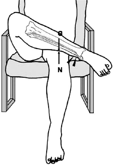 Figure 1 From The Crossed Leg Test For Examination Of Ankle Syndesmosis