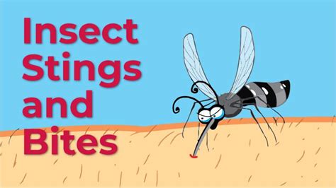 First Aid For Insect Bites And Stings