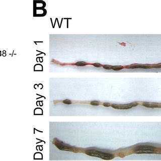 IEC MyD88 Mice Suffer Accelerated Tissue Damage During S Typhimurium