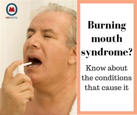 Burning Mouth Syndrome: Symptoms, Causes, and Treatment