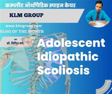 2024 Great Adolescent Idiopathic Scoliosis Klm Group