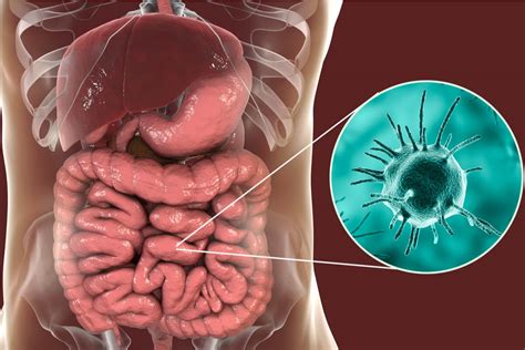 Curiosidades Sobre Salud Amebiasis Infecci N Parasitaria Del Colon