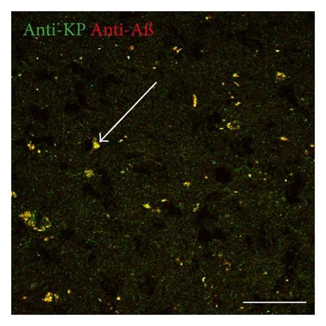 Double Labeling Immunofluorescence Demonstrating Colocalization Of Download Scientific Diagram