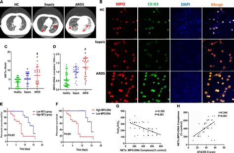 Frontiers Tissue Factor Enriched Neutrophil Extracellular Traps