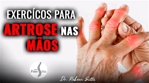 EXERCÍCIOS PARA ARTROSE NOS DEDOS DAS MÃOS FISIOTERAPIA MANUAL Clínica