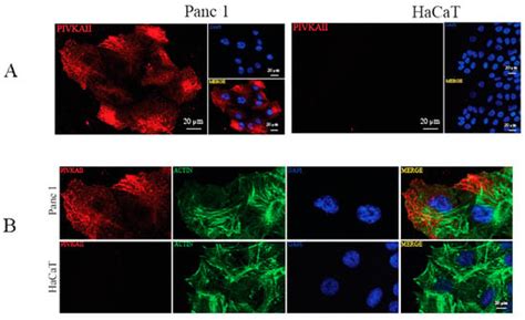 IJMS Free Full Text PANC 1 Cell Line As An Experimental Model For