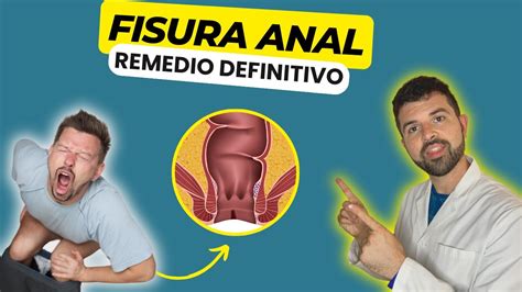 Descubre Como CURAR Una FISURA En El ANO YouTube