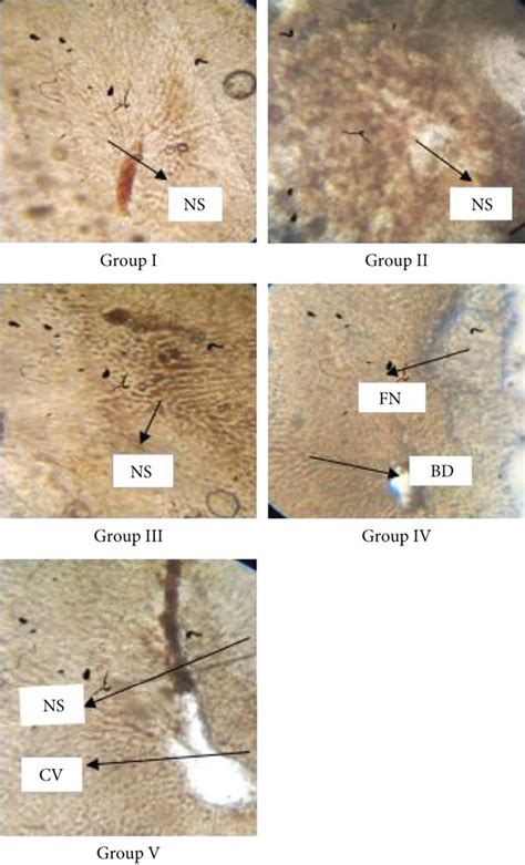 Histopathological Analysis Of The Liver Tissues Which Were Obtained