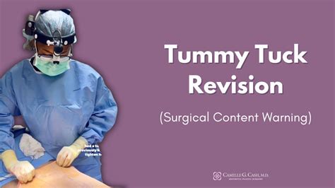 Whats Included In A Tummy Tuck Revision Dr Camille Cash In Houston