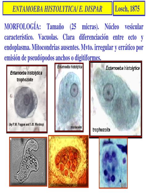 Entamoeba Histoytica Epidemiología Especialidades Medicas