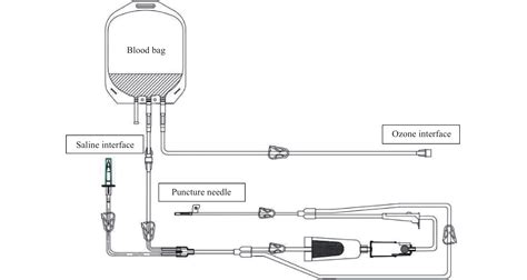 Expert Consensus On Standard Operating Procedures For Autologous