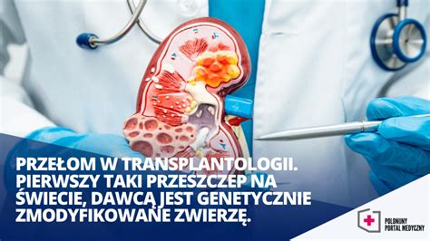 Prze Om W Transplantologii Pierwszy Taki Przeszczep Na Wiecie Dawc