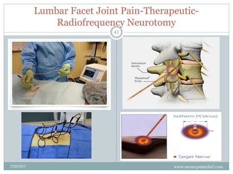 Ppt In Terventio Nal Pain Management For Chronic Spinal Pain