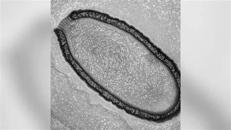 Giant Virus Resurrected From Permafrost After 30000 Years Fox News