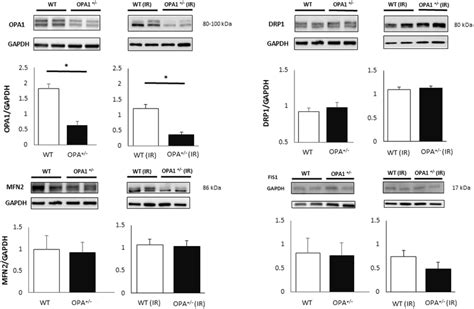 Baseline And Post Ir Fission And Fusion Protein Expression Opa1