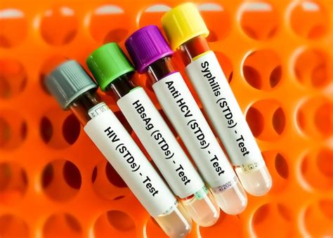 Premium Photo Close View Of Scientist Hand Hold Blood Samples For