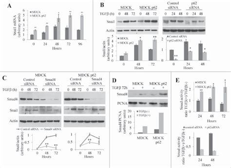 P62 Regulates The Expression Of Junctional Proteins Via The Smad Snail