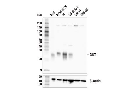 Gilt E P D Rabbit Mab Cell Signaling Technology