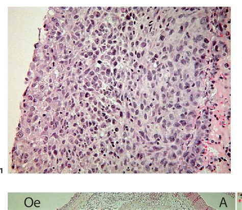 Figure From Preclinical Comparison Of Mthpc And Verteporfin For