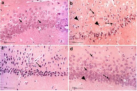 Histological Examination Of The Hippocampus CA1 Region After Staining