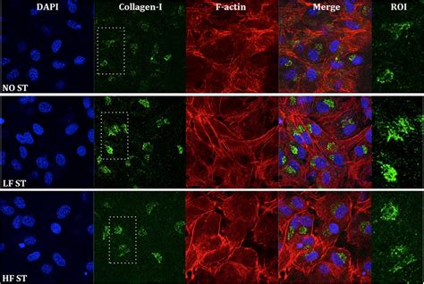 Confocal Microscopy Analysis Of Intracellular Collagen I In Mc3t3 Cells Download Scientific