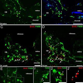 F Iba Retinal Microglia And Ciliary Macrophages In The Adult Mouse