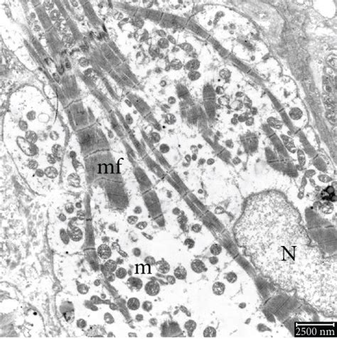 Electron Micrograph Of Human Atrial Tissues A Normal Nucleus