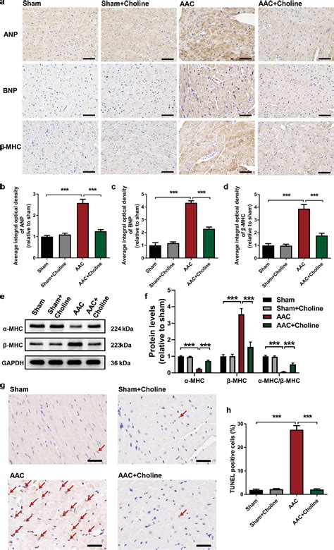 Amelioration Of Circadian Disruption And Calcium Handling Protein