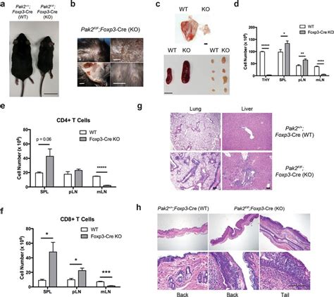 Treg Specific Loss Of Pak2 Results In A Lethal Multi Organ Autoimmune